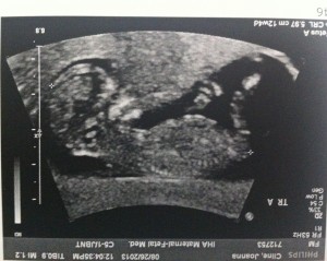 A_12wk