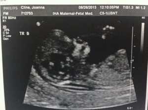 B_12wk