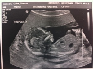 TripletA_16wks