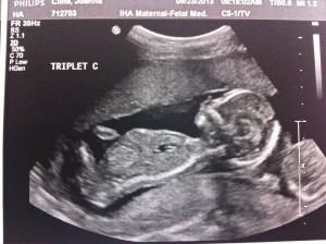 TripletC_16wks