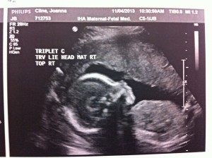 TripletC_22wks