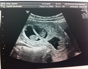 photo (21)